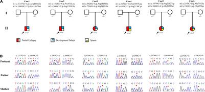 Recessive LAMA5 Variants Associated With Partial Epilepsy and Spasms in Infancy